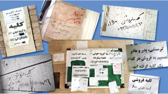 زيادة عدد المتقدمين ببيع الكلى سماع أصوات كسر عظام المواطنين في إيران