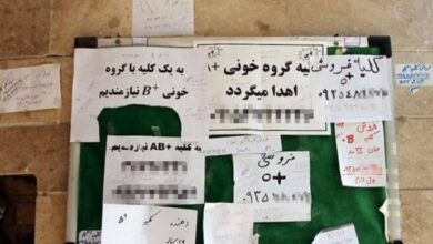 فقر و زيادة المتطوعين لبيع الكلي في ايران