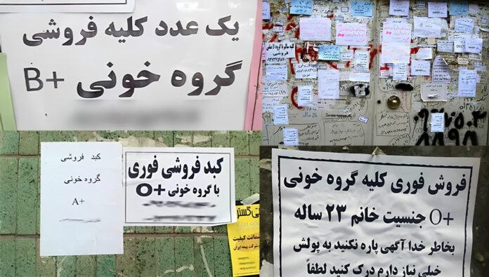 ميل اونلاين: البيع غير القانوني لأعضاء الجسم من قبل الإيرانيين وصل إلى مستوى ينذر بالخطر 