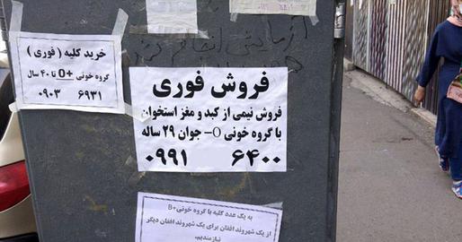 إيران: ارتفاع مبيعات أعضاء الجسم مع زيادة الفقر