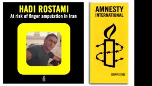 العفو الدولية تطالب بوقف فوري لأحكام بتر أصابع ثلاثة سجناء في إيران