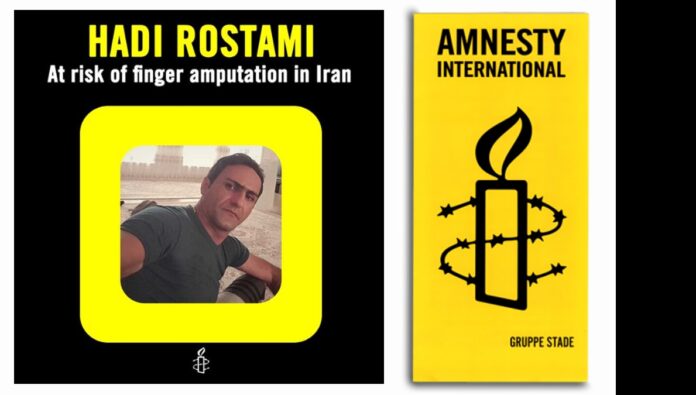 العفو الدولية تطالب بوقف فوري لأحكام بتر أصابع ثلاثة سجناء في إيران