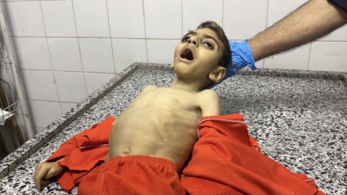 محمد مصطفى: إسرائيل تواصل استخدام التجويع كسلاح حرب و يُقتل في غزة يوميًا ما معدله 28 طفلًا فلسطينيًا