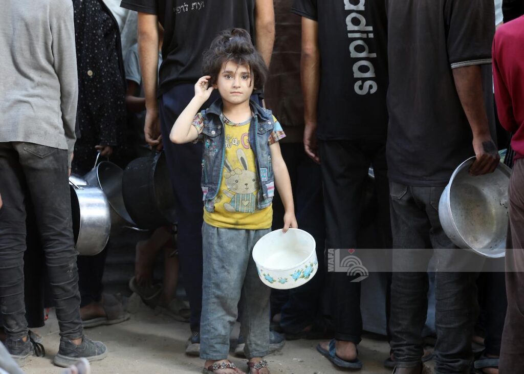 18 وفاة خلال 24 ساعة بسبب الجوع في غزة